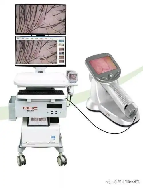 重磅消息余庆县首台电子皮肤镜落户县中医医院