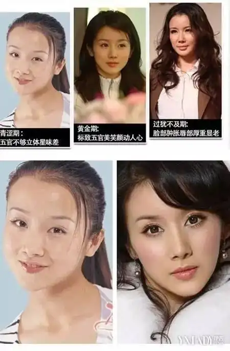 杨幂承认四小花动刀最多 郑爽赵丽颖开扒整容女星