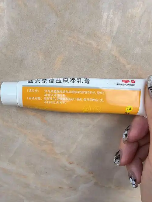 湿疹救星曲安奈德益康唑乳膏