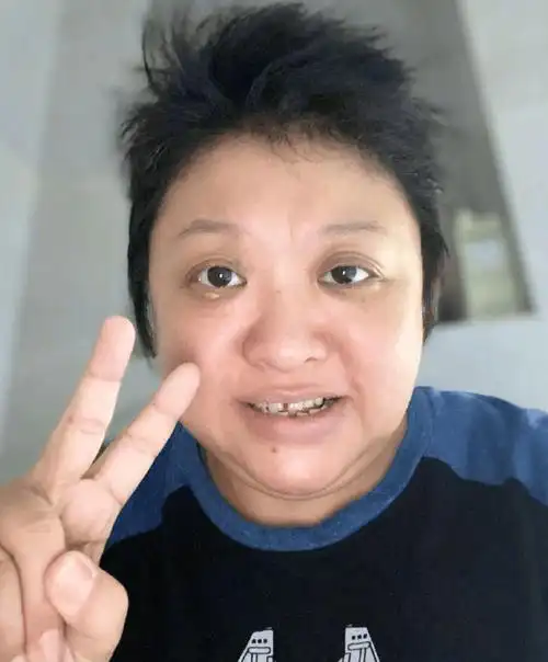 韩红近况曝光!身材暴瘦眼睛肿胀,牙齿缺了好几个,戴廉价手表