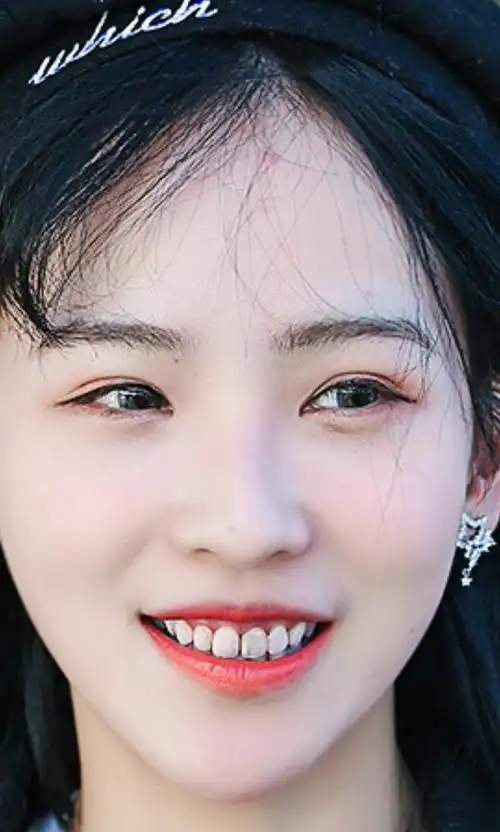 一直想问蒋申的牙是咋回事