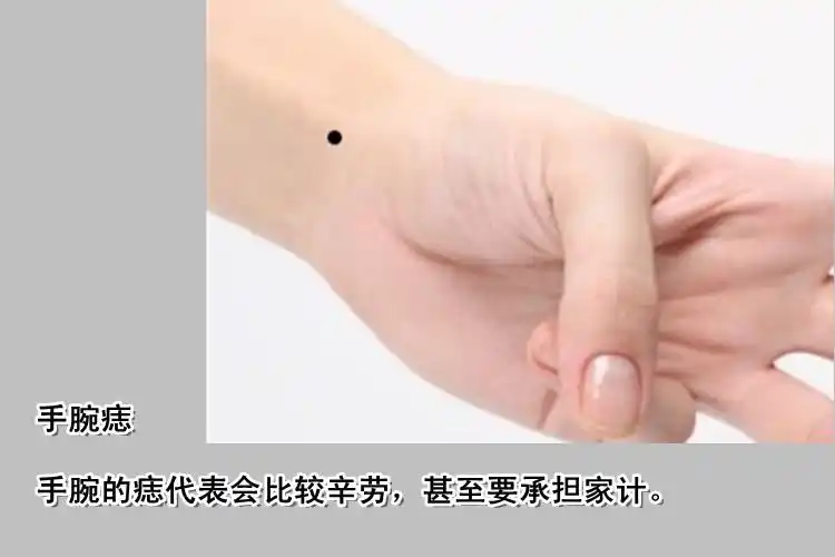 真人全身痣相图解 - 王黄是一家 - hgs19641221的博客