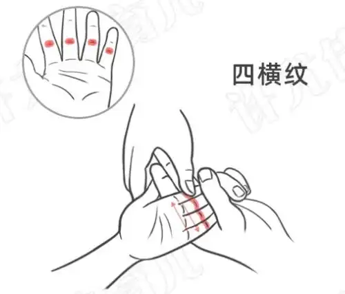 运板门100~300次,掐揉四横纹3~5次,四横纹和板门相配的手法