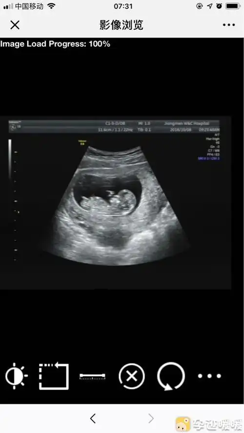 翻12周拍的nt图给大家看看男女.