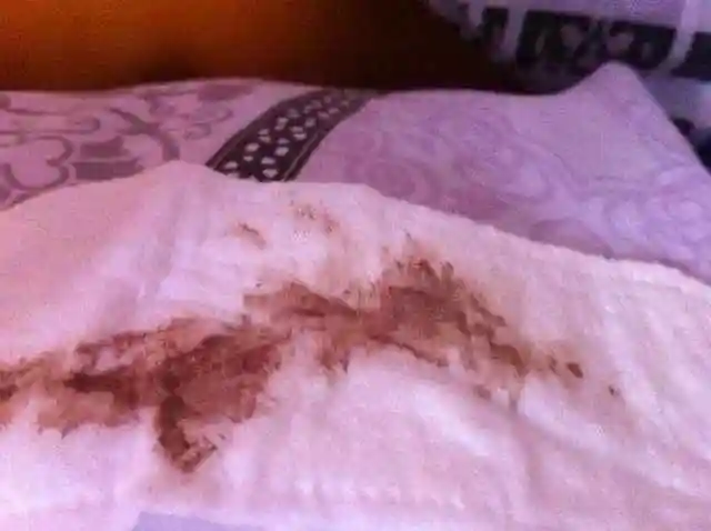 孕期妈妈们出现这三种症状不要大意很可能是胎停的信号