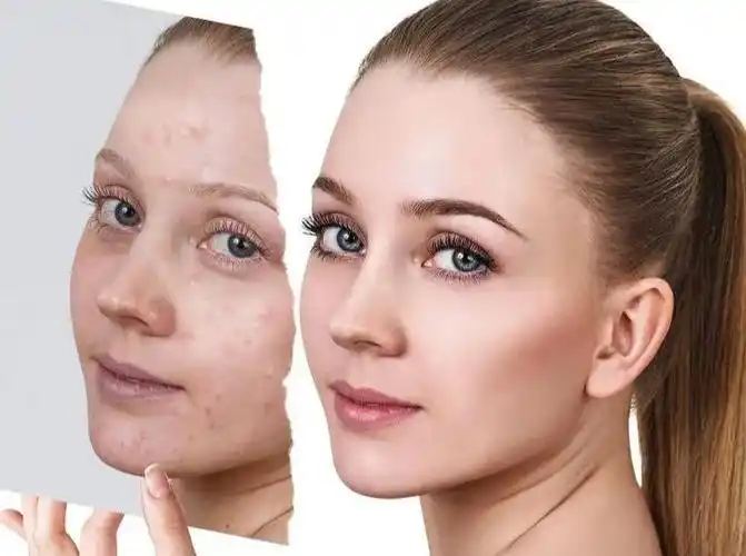 如何修复敏感肌肤?苗莲花效果如何?