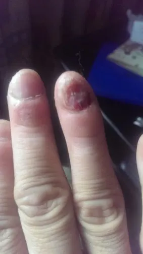 二十多年出神入化的咬指甲绝技