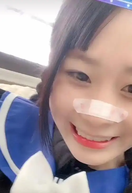 为什么女的喜欢在鼻子上贴一个创可贴 她真实样子图(个人资料)