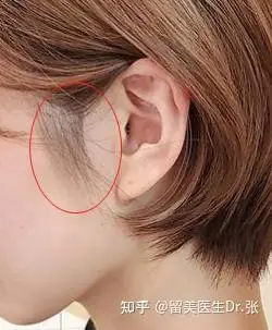 做小拉皮,鬓角你想留还是不留? - 知乎