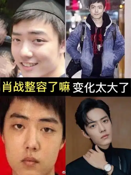 99肖战有做过眼睑下至[|]吗?