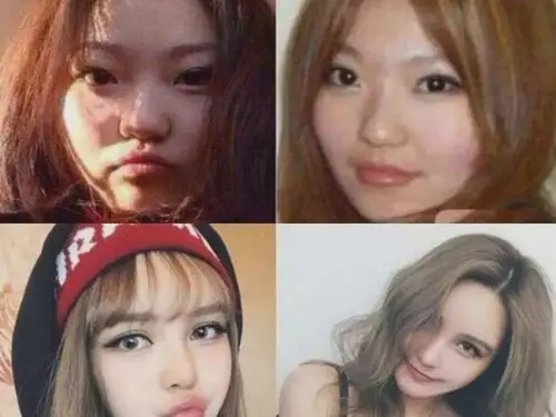 周扬青整容前曝光,大饼脸单眼皮不忍直视