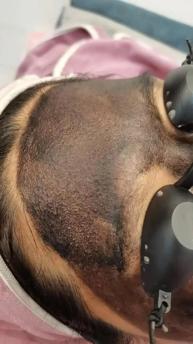 长期上不上妆,皮肤暗淡无光,起皮,黑脸娃娃高能量碳爆破会祛除 - 抖音