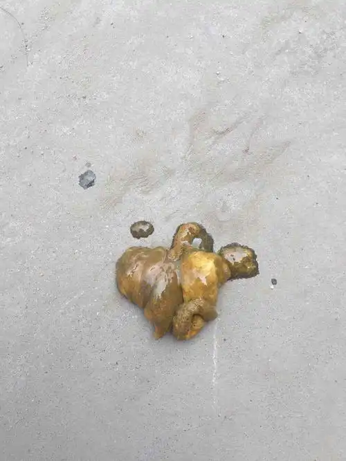 希望大家别嫌恶心 帮我看一下吧