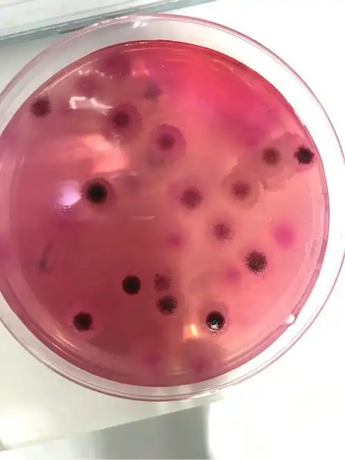 大家快帮我先看下这个黑色的霉菌是什么菌种