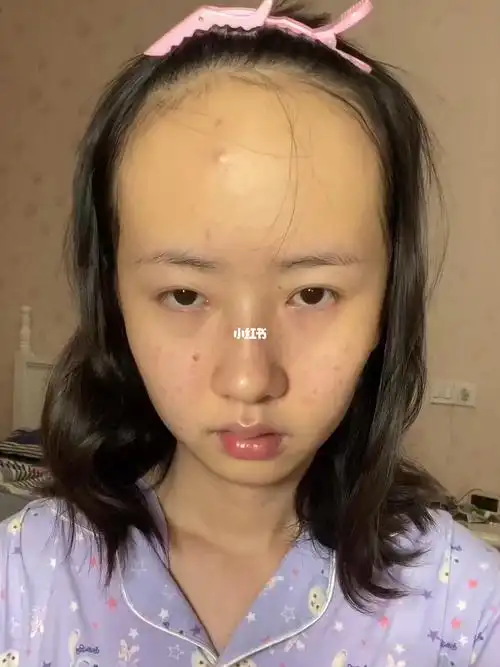 发际线高的女生都是潜力股