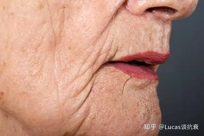 2. 皮肤松弛: 多肽类,神经酰胺