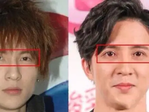 男明星整容也不含糊!第二弹