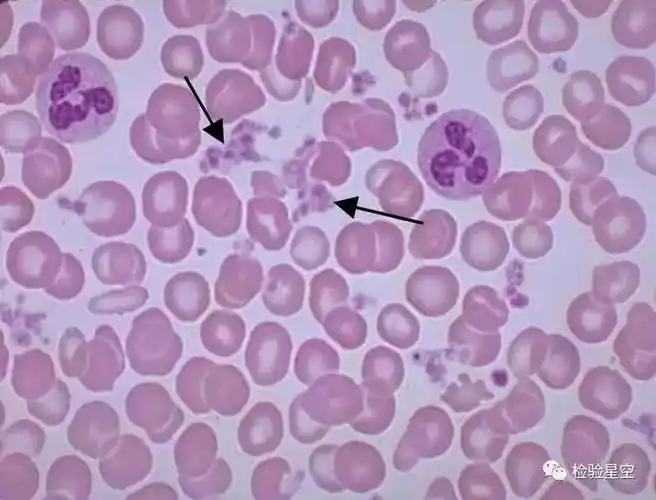 红细胞|淋巴细胞|粒细胞|血小板_网易订阅