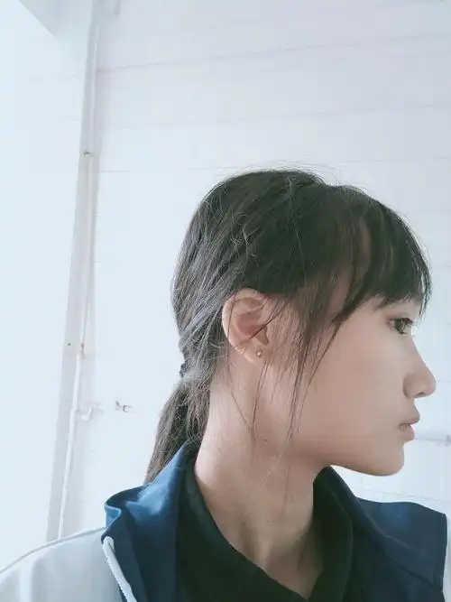 友友们康康这扁头严重吗