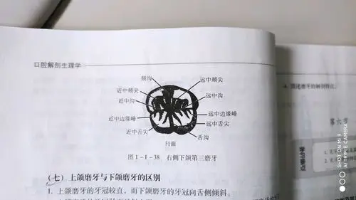 右侧下颌第三磨牙