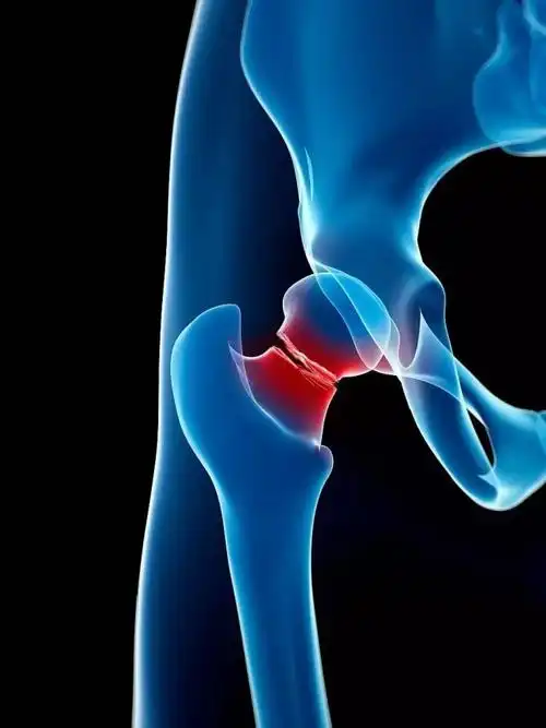 出现跌打损伤会导致骨折吗?对于常见摔倒撞伤应该如何处理?