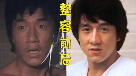 一整人生开挂的明星,金晨削骨变尤物,成龙割双眼皮迎来事业巅峰