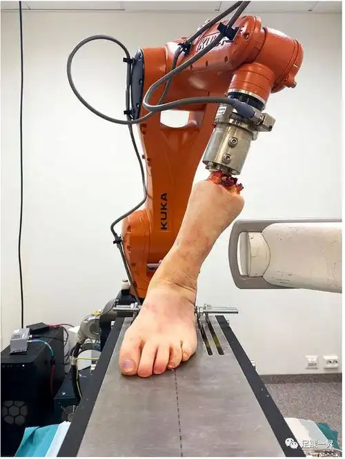 本研究采集新鲜冷冻的人尸体足和踝关节标本,并使用了一个落地式工业