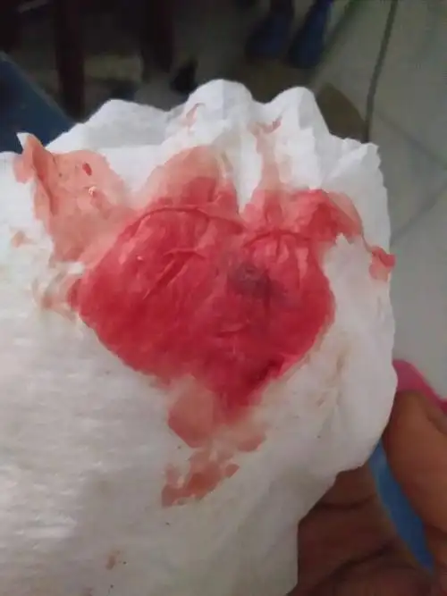 这个是什么颜色的血