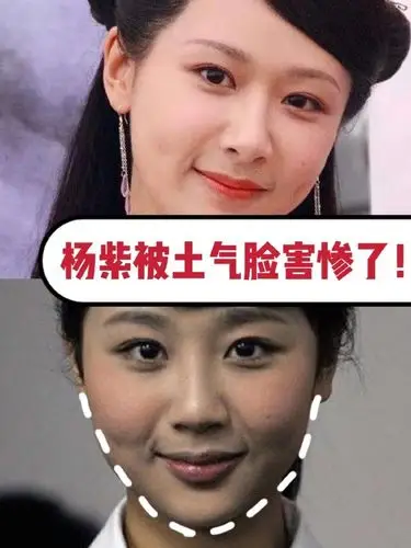 杨紫为什么多次整容还摆脱不了土气
