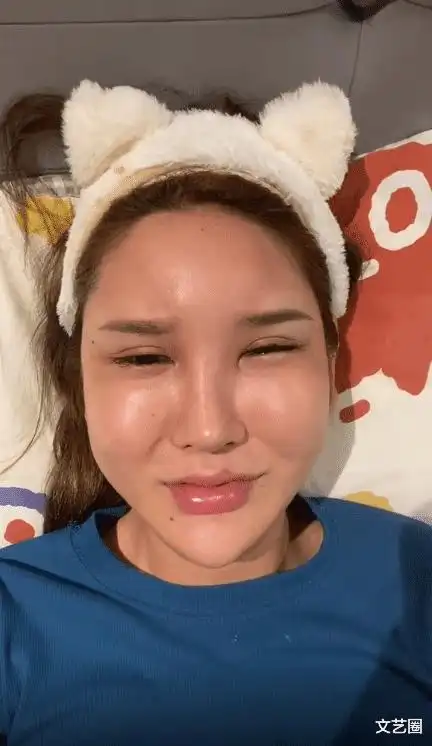 女网红整容失败出现严重后遗症,脸肿成馒头眼睛睁不开,崩溃痛哭称自己