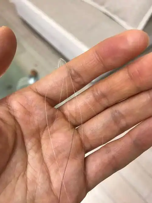 最近居然长了几根白头发{:boy-cry:}