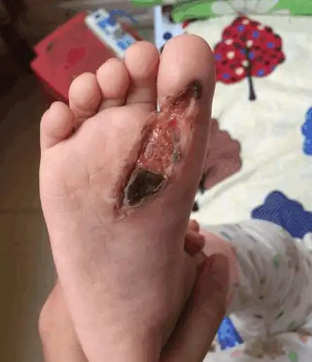 骑电车带宝宝注意了宝宝坐在电车上按得座椅脚底的皮全部蹭掉