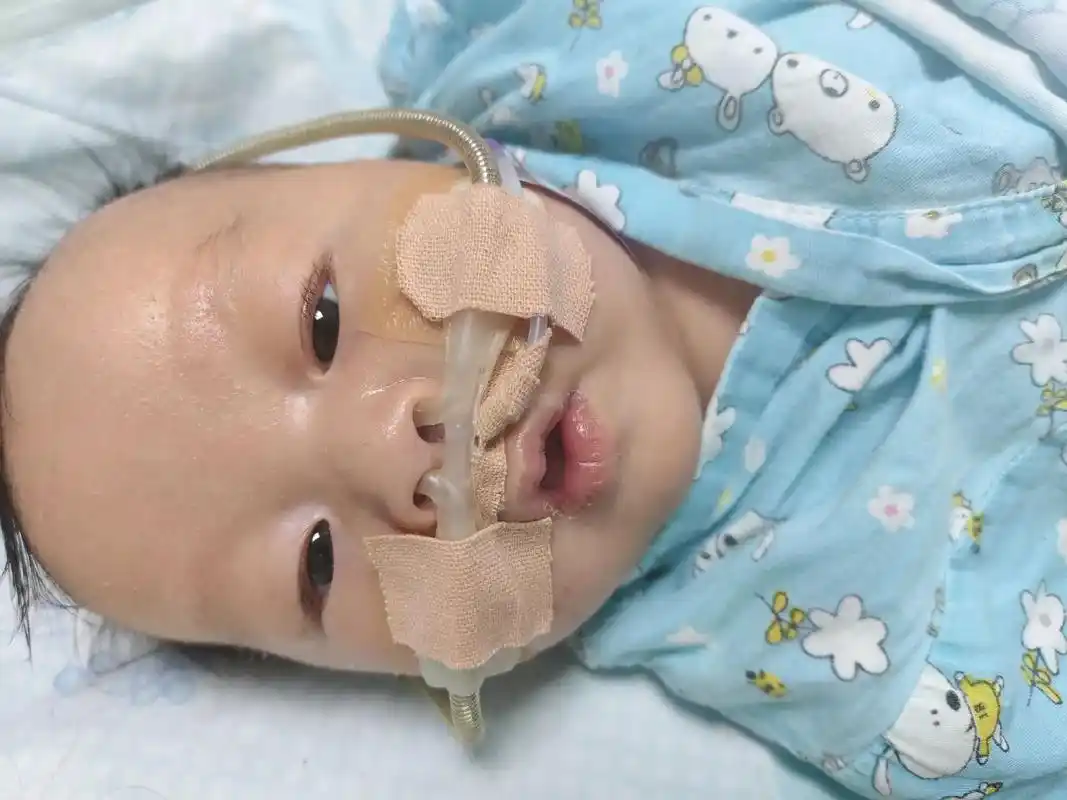 重症肺炎和腺病毒在重症监护室里二十多天了终于好转了,我真的好 - 抖