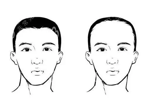 乌鲁木齐发际线植发多少钱?植发医院和整形医院价格表都给你
