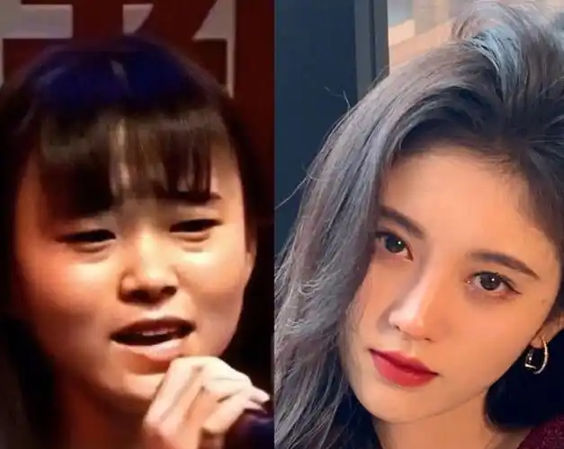 5位整容明星:有的事业全毁靠直播卖货生存,有的却被网友叫好