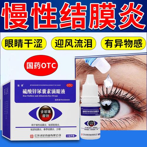 红血丝眼睛干痒眼疲劳异物感怕光流泪睁不开眼 硫酸锌尿囊素滴眼液