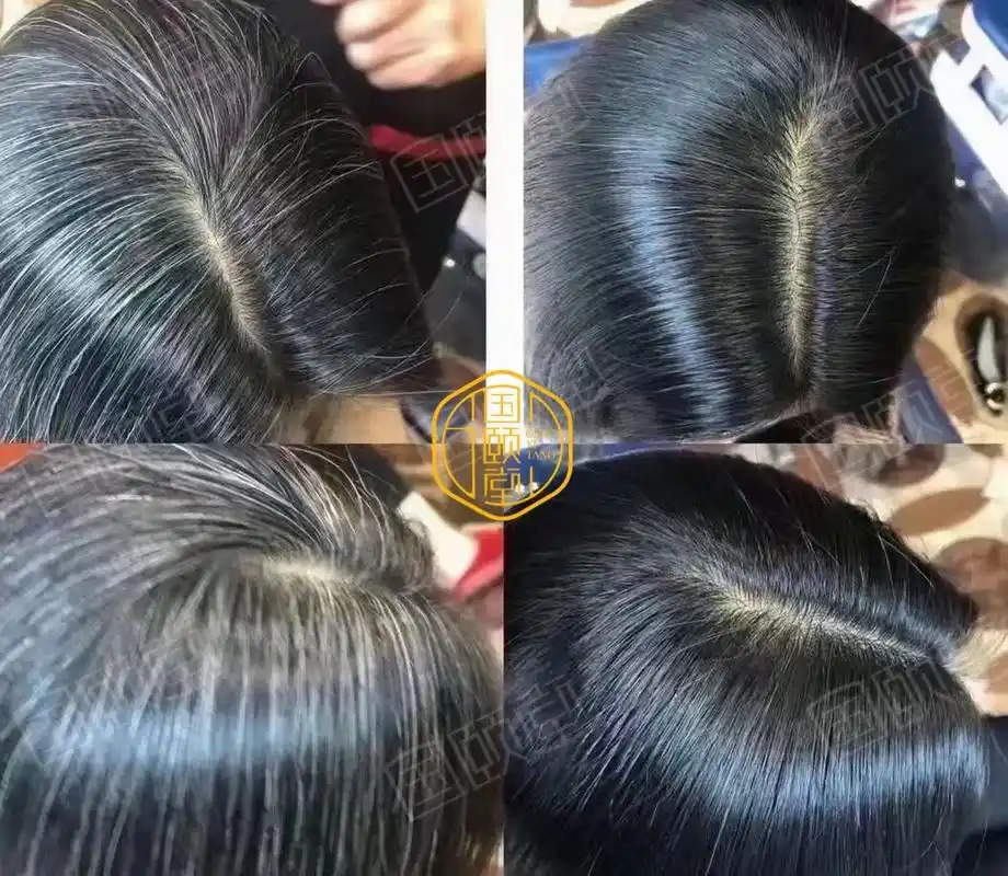 治白发,专业养发馆效果行不行