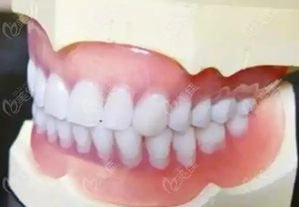 标准的牙齿咬合图片