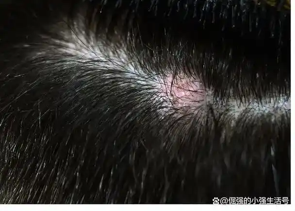 头发根部的小白点是什么?是把毛囊拔出来了吗?