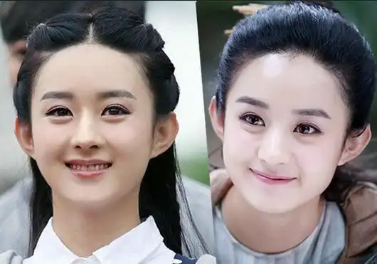 赵丽颖发际线说不上靠后,但就是很奇怪!犹如被剃了一般.