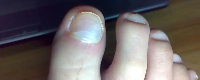 二脚趾比大脚趾长代表什么