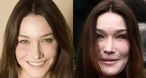 明星整容前后照片对比惊人 整容失败惨不忍睹的十大女星