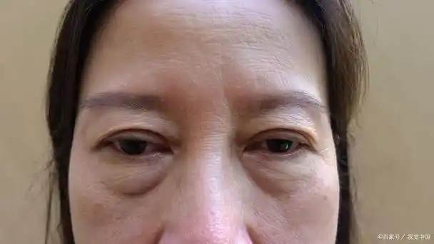 单单只是补水就起到延缓皮肤衰老的效果吗?