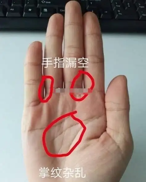 金星丘有痣,富裕之象,只要持之以恒,好日子等着你