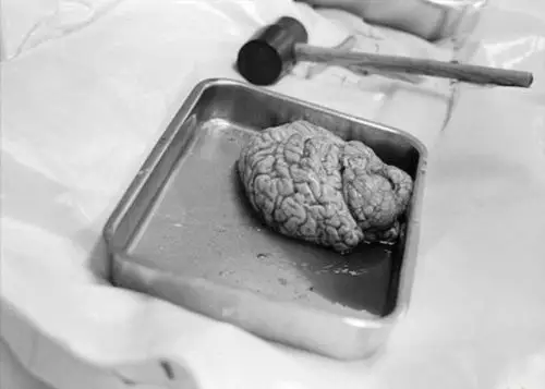 揭秘法医如何让死者"说话"(组图)