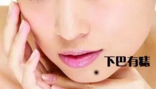 7,腮骨处长痣看相算命图解腮骨是下巴的外延者,如果腮骨有痣,代表坚持