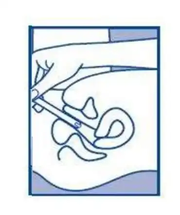 霉菌性阴道炎反反复复?药师教您正确用药,摆脱难言之隐