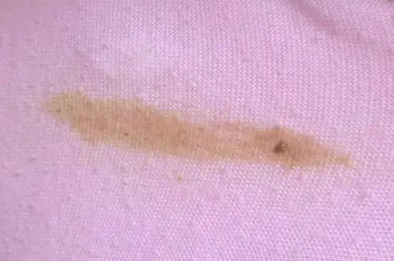 九,出现分泌物的反应妇科疾病在灸的时候,根据病症的不同,在用艾条去