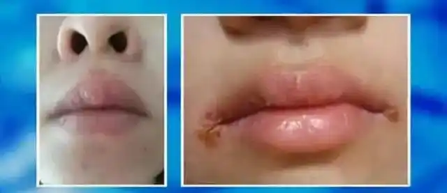 人体的危险三角区不可不防,一旦异常,很可能是大病征兆!