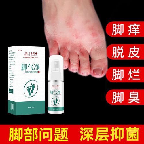 曲安奈德益康唑喷雾益康喷雾皮炎烂脚丫足烂脚脚臭糜烂益康挫喷雾